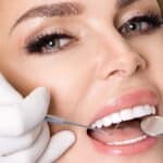 Closeup of dental veneer check on smiling woman teeth
