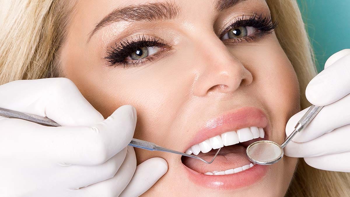 Closeup of dental veneer check on smiling woman teeth