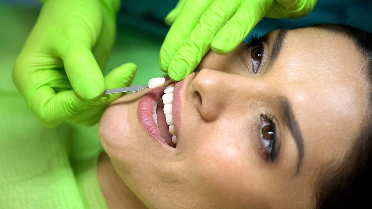 Dentist holding a veneer up to a patient’s front tooth for placement.