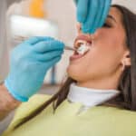 Common Dental Emergencies in Woodinville