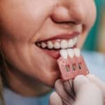 Veneer problems Woodinville