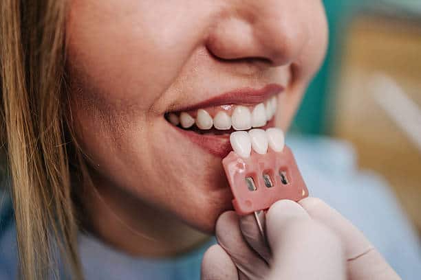 Veneer problems Woodinville