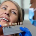 veneers vs crowns Woodinville